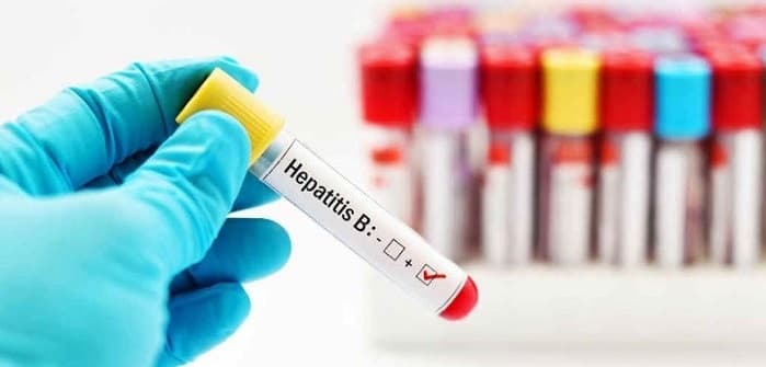 قبل از کاشت مو برای HIV و هپاتیت آزمایش بدهید و یک معاینه پزشکی عمومی انجام دهید