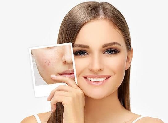 مراقبت‌های پس از هیدروفیشیال صورت