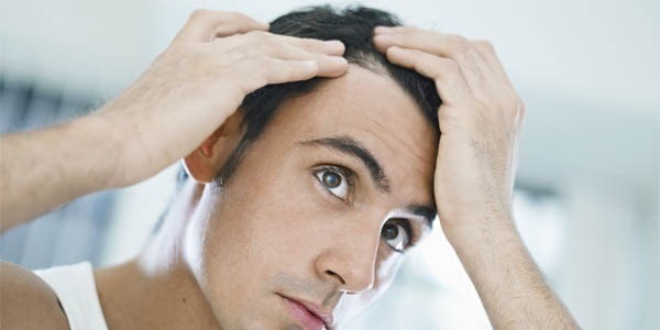 تشخیص کاندیدای مناسب کاشت مو با ناحیه اهدا کننده