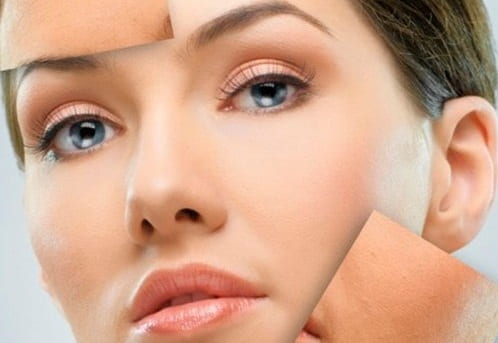 مزایای روش کربوکسی تراپی