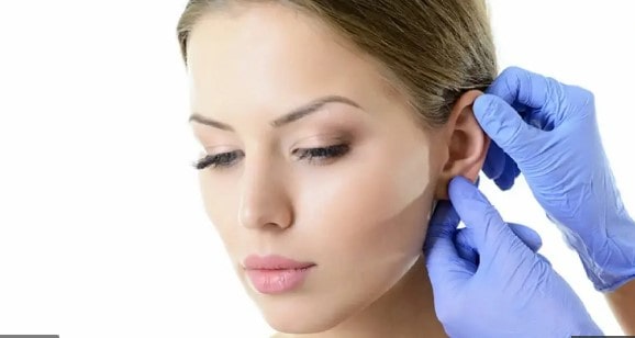 اتوپلاستی گوش نحوه عمل، مراقبت های قبل و بعد از جراحی زیبایی گوش